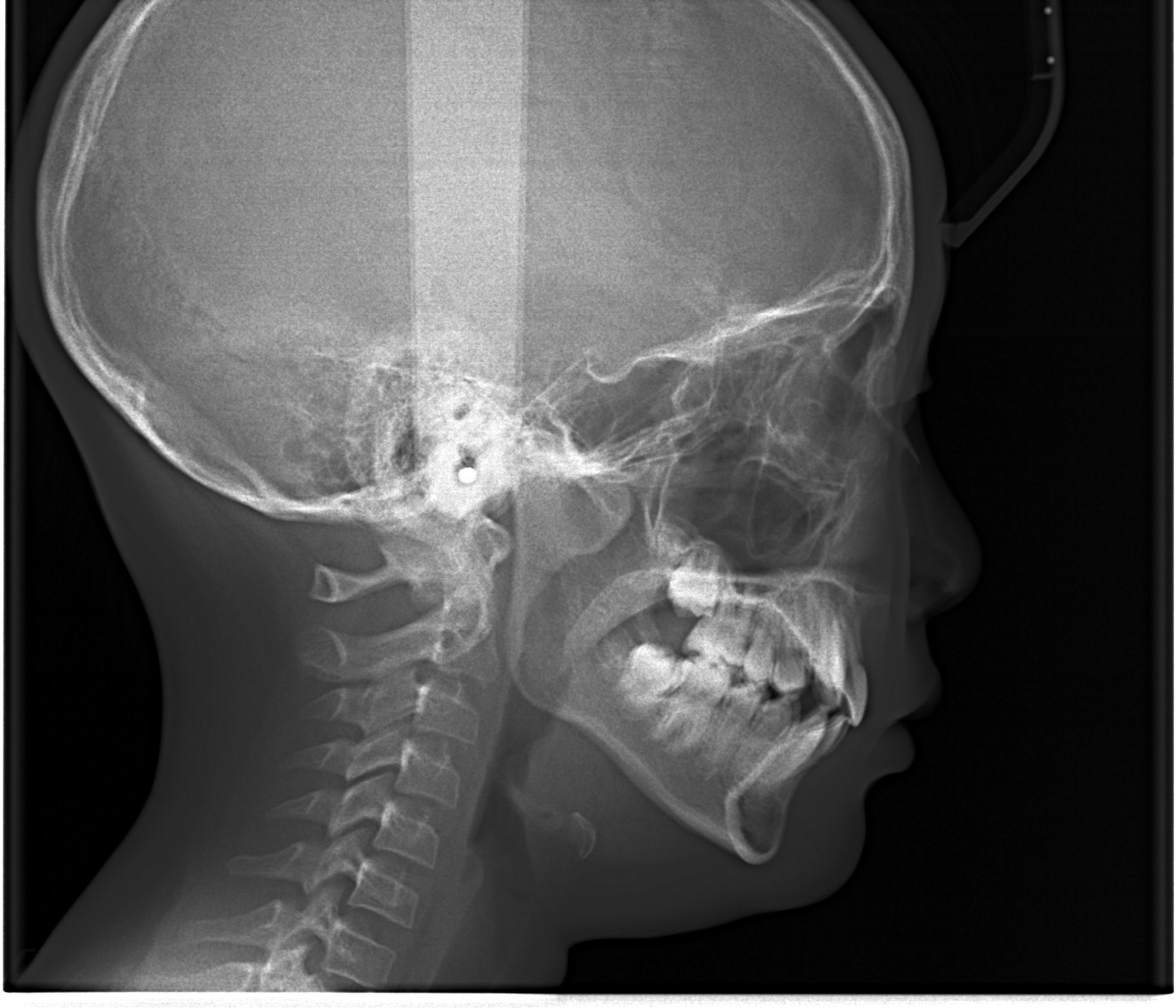 レントゲン１１