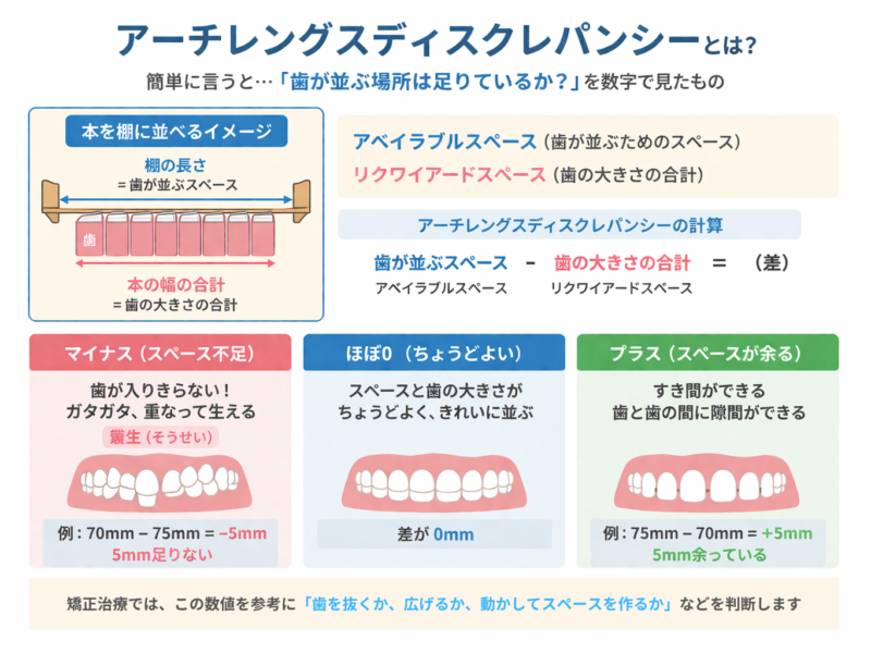 アーチレングスディスクれパンシーの説明